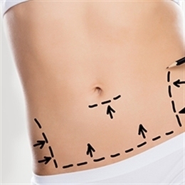 liposakciya-v-turcii