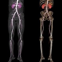 perifericheskaya-angiografiya-sosudov