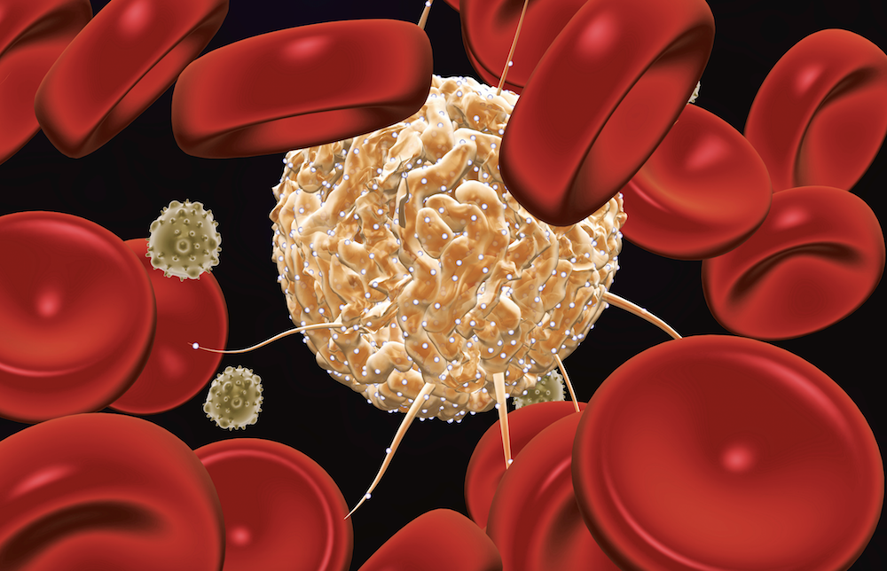 transplantacziya-kostnogo-mozga-i-stvolovykh-kletok