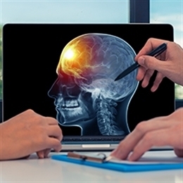 opuholi-golovnogo-mozga-o-metodah-lecheniya-v-turcii