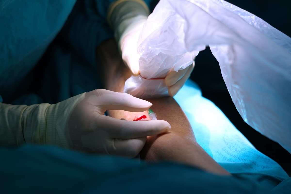 radialnaya-angiografiya